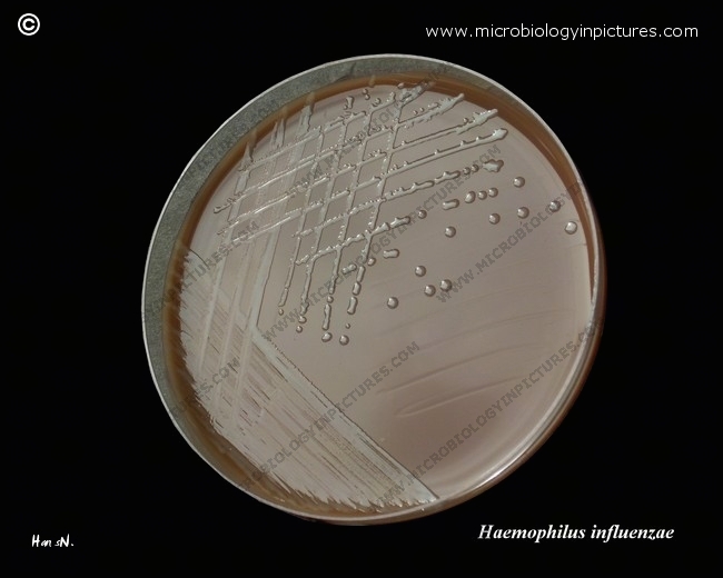 haemophilus influenzae group b